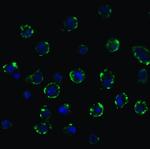 ACE2 Antibody in Immunocytochemistry (ICC/IF)