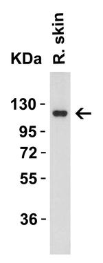 ACE2 Antibody in Western Blot (WB)