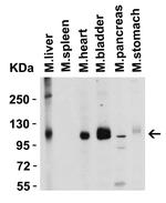 ACE2 Antibody in Western Blot (WB)