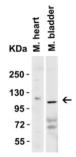 ACE2 Antibody in Western Blot (WB)