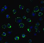 ACE2 Antibody in Immunocytochemistry (ICC/IF)