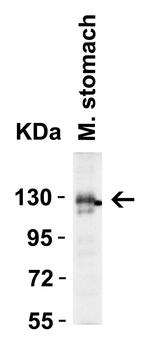 ACE2 Antibody in Western Blot (WB)