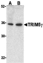 TRIM5 gamma Antibody in Western Blot (WB)