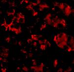 TRIM5 alpha Antibody in Immunocytochemistry (ICC/IF)