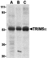 TRIM5 alpha Antibody in Western Blot (WB)