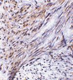 TRIM5 alpha Antibody in Immunohistochemistry (IHC)