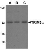 TRIM5 alpha Antibody in Western Blot (WB)