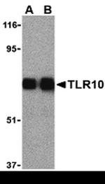 TLR10 Antibody in Western Blot (WB)