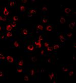 TLR11 Antibody in Immunocytochemistry (ICC/IF)