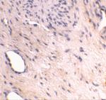 ARMER Antibody in Immunohistochemistry (IHC)