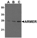 ARMER Antibody in Western Blot (WB)