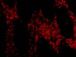 HTRA2 Antibody in Immunohistochemistry (IHC)