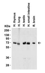 cIAP1 Antibody in Western Blot (WB)