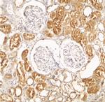 XIAP Antibody in Immunohistochemistry (IHC)