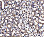 XIAP Antibody in Immunohistochemistry (IHC)