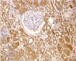 Bcl-2 Antibody in Immunohistochemistry (Paraffin) (IHC (P))