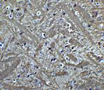 Bcl-2 Antibody in Immunohistochemistry (Paraffin) (IHC (P))