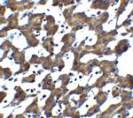 ST2 Antibody in Immunohistochemistry (IHC)