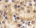 ST2 Antibody in Immunohistochemistry (IHC)