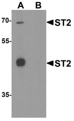 ST2 Antibody in Western Blot (WB)