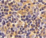 UBC13 Antibody in Immunohistochemistry (IHC)