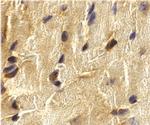 ECSIT Antibody in Immunohistochemistry (IHC)