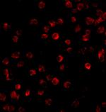 Btk Antibody in Immunocytochemistry (ICC/IF)