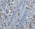 Btk Antibody in Immunohistochemistry (IHC)