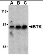 Btk Antibody in Western Blot (WB)