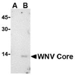 West Nile Virus Core Antigen Antibody in Western Blot (WB)