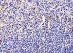 Caspase 1 Antibody in Immunohistochemistry (IHC)