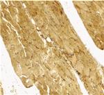 Caspase 7 Antibody in Immunohistochemistry (IHC)