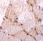 Caspase 7 Antibody in Immunohistochemistry (IHC)