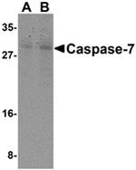 Caspase 7 Antibody in Western Blot (WB)