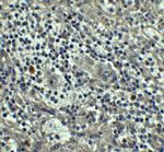 Caspase 8 Antibody in Immunohistochemistry (IHC)