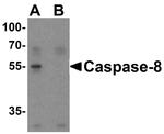 Caspase 8 Antibody in Western Blot (WB)