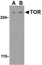 mTOR Antibody in Western Blot (WB)