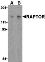 Raptor Antibody in Western Blot (WB)