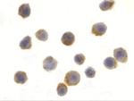 TSC1 Antibody in Immunocytochemistry (ICC/IF)