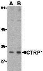 CTRP1 Antibody in Western Blot (WB)