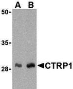 CTRP1 Antibody in Western Blot (WB)