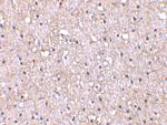 CTRP5 Antibody in Immunohistochemistry (IHC)