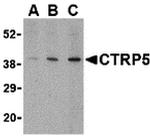 CTRP5 Antibody in Western Blot (WB)