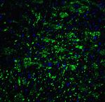 H-cadherin Antibody in Immunohistochemistry (IHC)