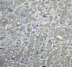 H-cadherin Antibody in Immunohistochemistry (IHC)