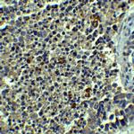 Beclin 1 Antibody in Immunohistochemistry (IHC)