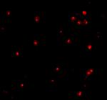 ATG7 Antibody in Immunocytochemistry (ICC/IF)