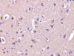 CRMP1 Antibody in Immunohistochemistry (IHC)