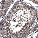 PIST Antibody in Immunohistochemistry (IHC)