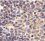 TLR1 Antibody in Immunohistochemistry (IHC)